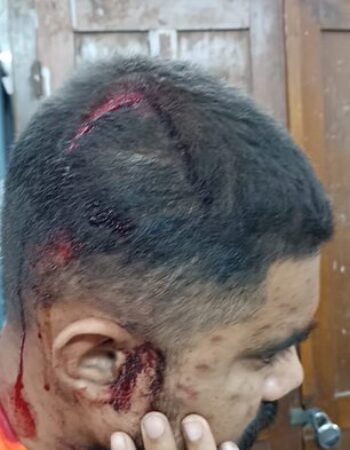 Hanuman Janmotsav rally attacked by radical Islamists [ Odisha, India ]