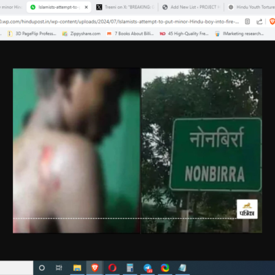 Minor Hindu Boy Burned in Muharram Bonfire Altercation [Korba, Chhattisgarh]